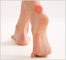Achilles Tendonitis Treatment